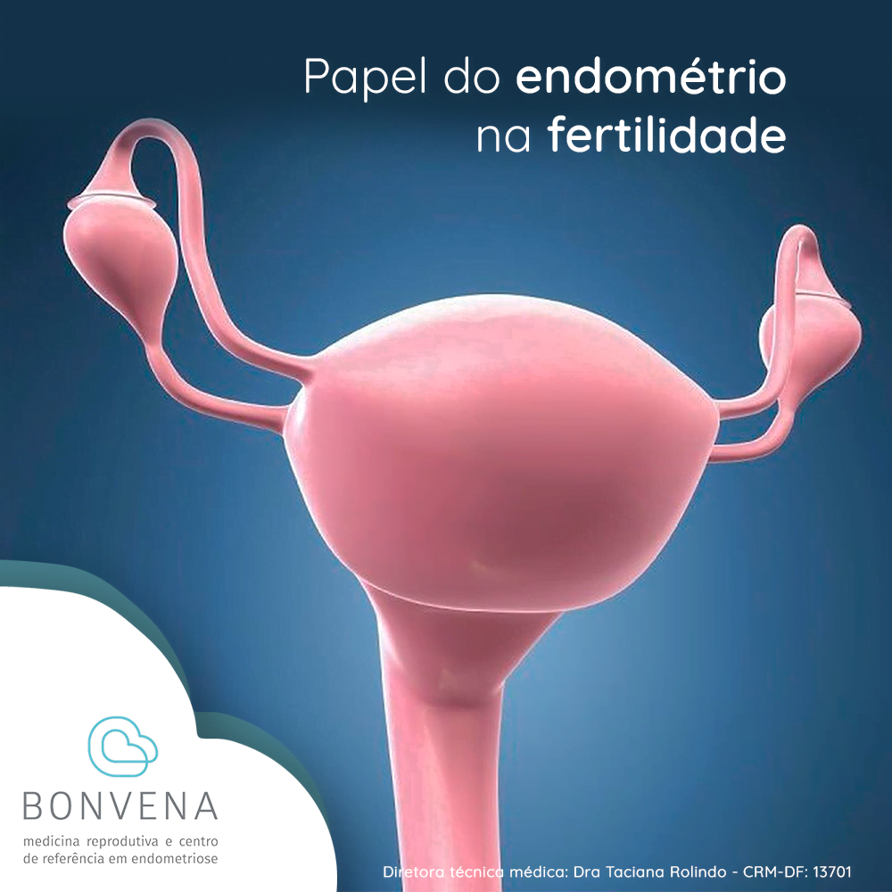 Endometriose  CheckUp da Fertilidade